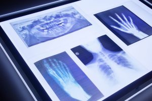 radiografías cuerpo humano en la mesa de luz
